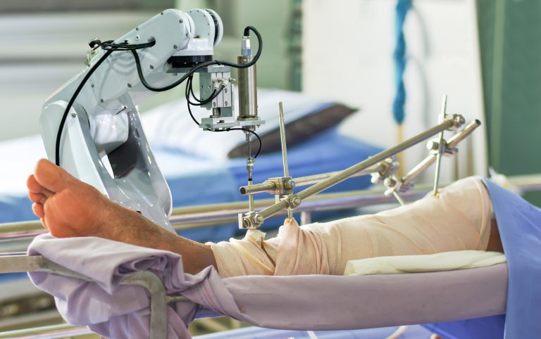 robotic natural knee replacement in Vadodara