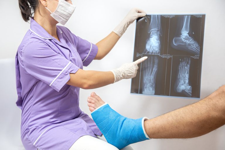 ACL Surgery in Vadodara