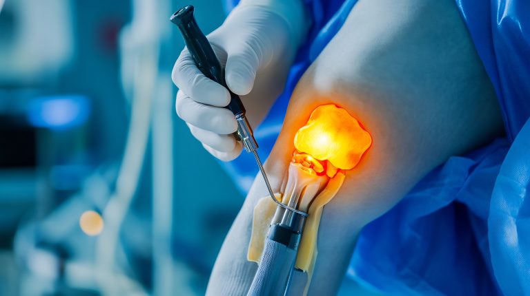 Common Signs You Might Need Arthroscopy