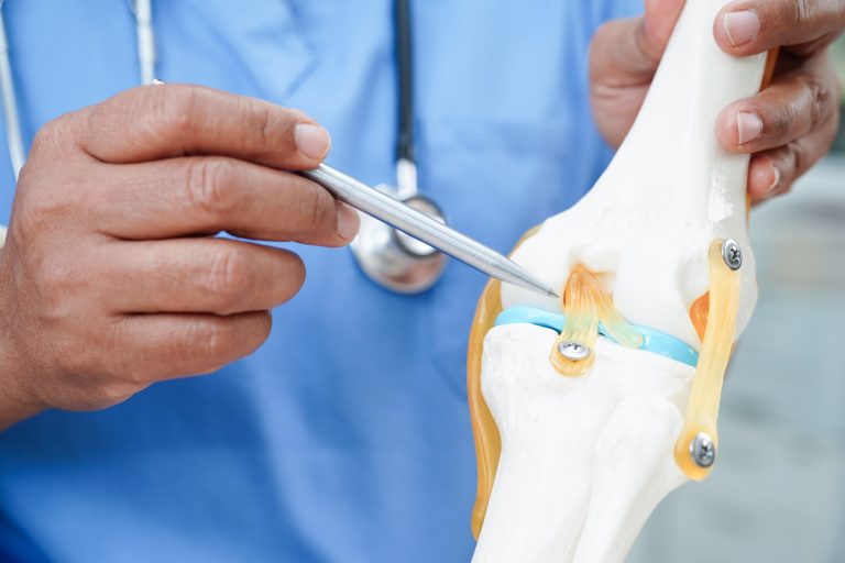Best knee replacement surgeon in vadodara